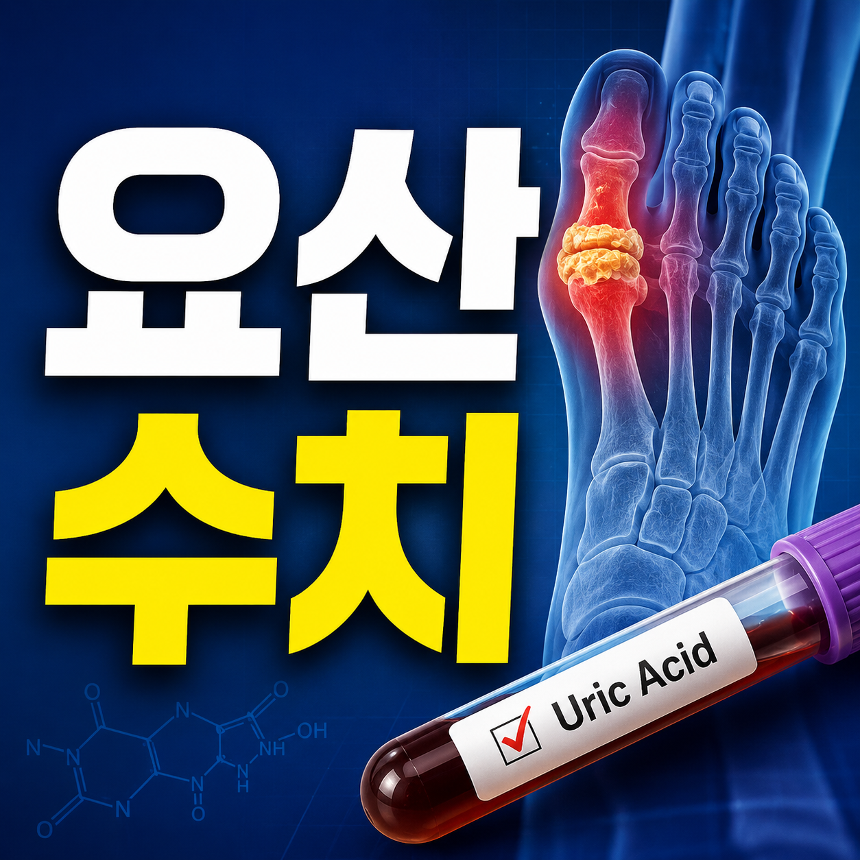 요산 수치