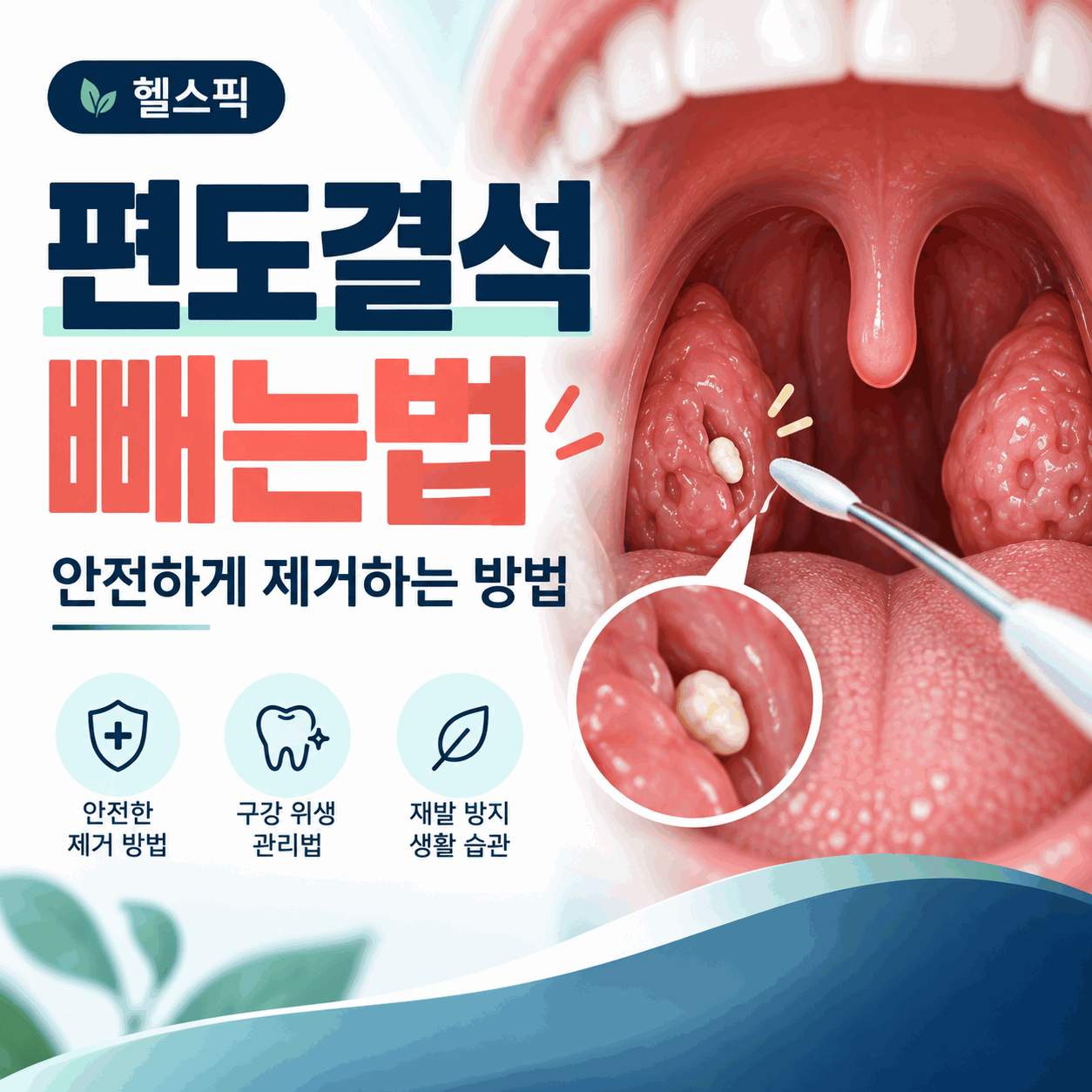 편도결석 빼는법